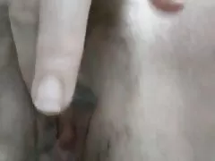 대만 알렉시스 텍사스 병 Lin part3