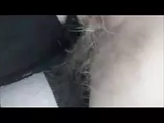 의 꿈:털이 armpits29