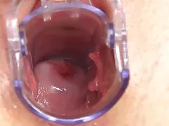 간호사 레 그녀의 자 궁을 보여줍니다.