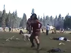 의 꿈:털이 armpits19