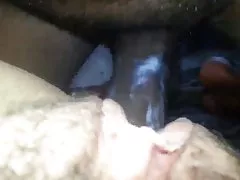 임신부 망에 의해 BBC-이스라엘의 사례)전 creaming