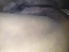 지방 털이 항문