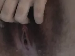 털이 영원히다-3