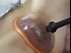 프랑스 성숙에게 큰 성구 사건으로 그녀의 음부 양수했습니다