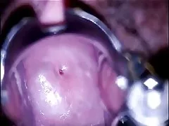 실험 비디오에서 털이 성숙한 여인 2